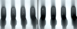 Figure 4. X-ray with lead (left) and lead-free